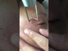 la macchina 1064nm 532nm Q del laser di picosecondo 450ps ha commutato il ND Yag