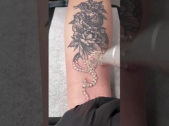 la macchina 1064nm 532nm Q del laser di picosecondo 450ps ha commutato il ND Yag